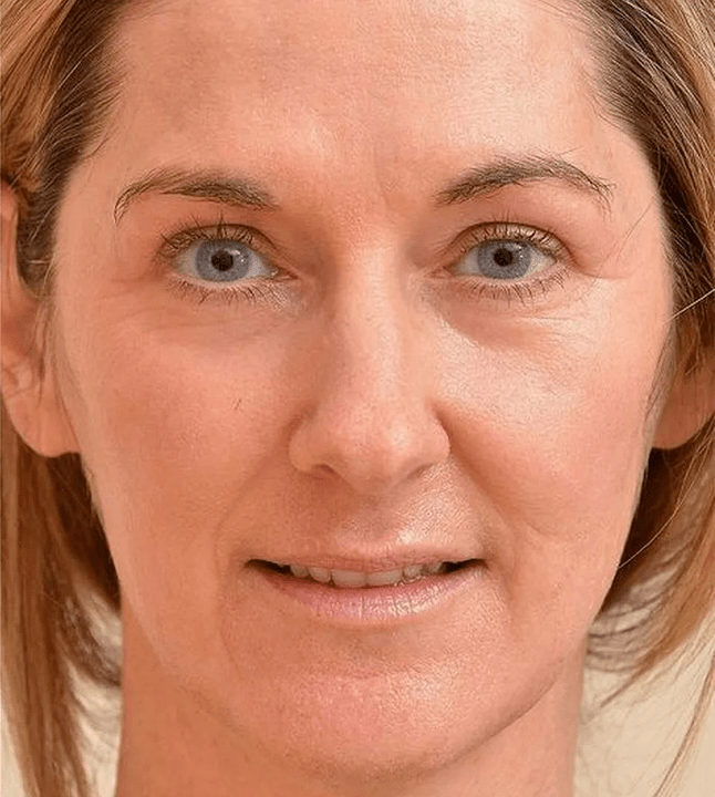 After using Eudalie Cream I look younger