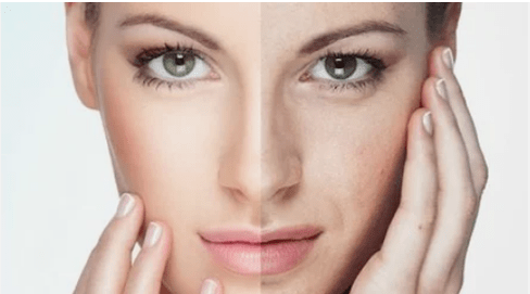 Effective renewal of the face